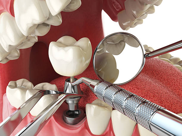 Best Emergency Dental Services for Seniors in Villanova, PA